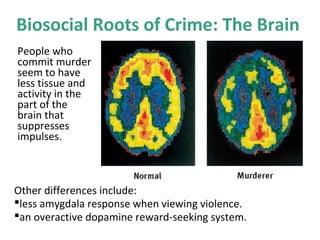 Biosocial Roots of Crime: The Brain
People who
commit murder
seem to have
less tissue and
activity in the
part of the
brain that
suppresses
impulses.
Other differences include:
less amygdala response when viewing violence.
an overactive dopamine reward-seeking system.
 