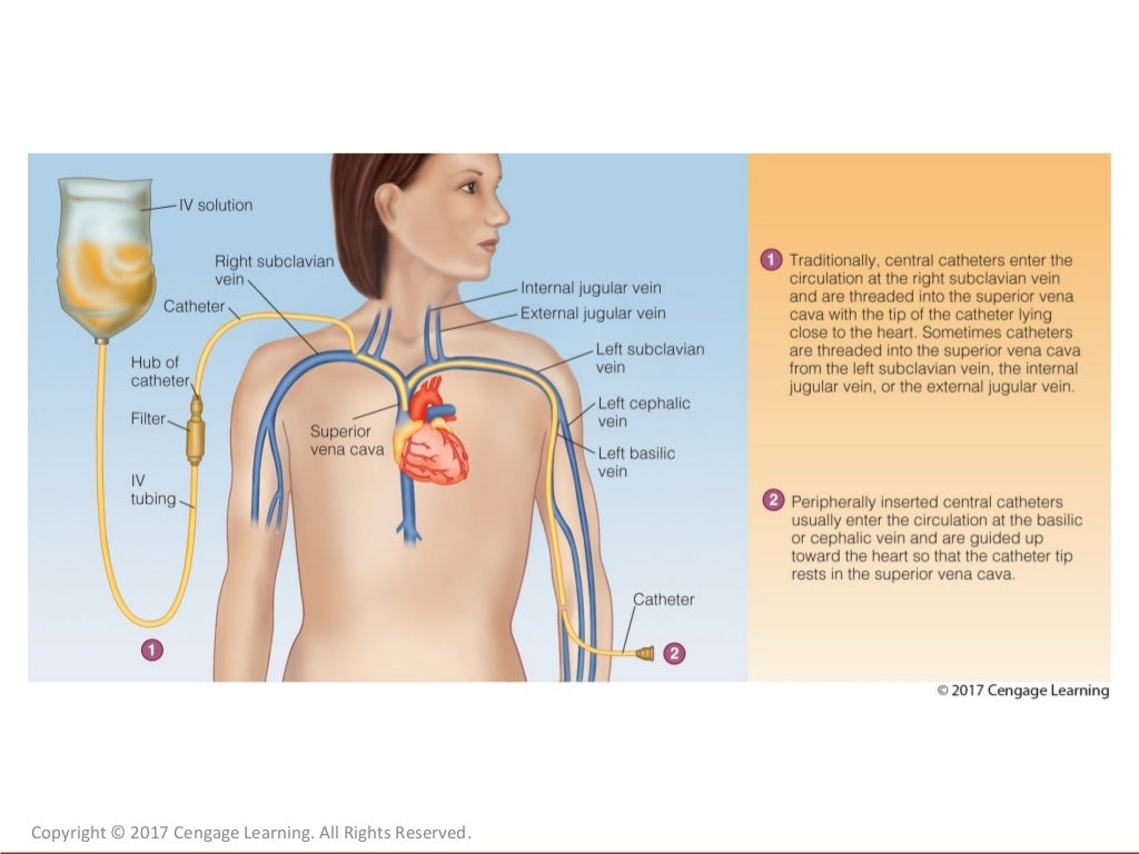 Chapter 15 Enteral and Parenteral Nutrition Support