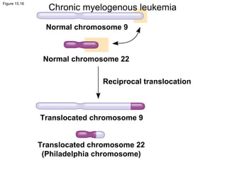 Figure 15.16
Normal chromosome 9
Normal chromosome 22
Reciprocal translocation
Translocated chromosome 9
Translocated chromosome 22
(Philadelphia chromosome)
Chronic myelogenous leukemia
 