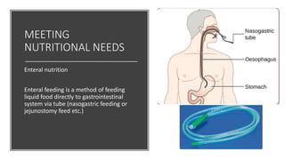 MEETING
NUTRITIONAL NEEDS
Enteral nutrition
Enteral feeding is a method of feeding
liquid food directly to gastrointestinal
system via tube (nasogastric feeding or
jejunostomy feed etc.)
 