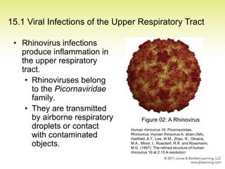 Viral Infections of the Respiratory Tract and Skin | PPT