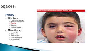 Primary
• Maxillary
o Vestibular/Palatal
o Buccal
o Canine
o Infratemporal
• Mandibular
o Vestibular
o Submental
o Submandibular
o Sublingual
 