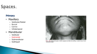 Primary
• Maxillary
o Vestibular/Palatal
o Buccal
o Canine
o Infratemporal
• Mandibular
o Vestibular
o Submental
o Submandibular
o Sublingual
 
