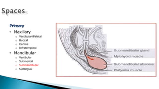 Primary
• Maxillary
o Vestibular/Palatal
o Buccal
o Canine
o Infratemporal
• Mandibular
o Vestibular
o Submental
o Submandibular
o Sublingual
 