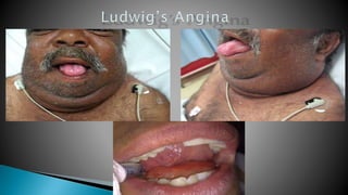 chapter16-161027084810.pptx