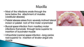 • Most of the infections erode through the
bone below the attachment of muscles
(vestibularabscess)
• Palatal abscessarises from severely inclined lateral
incisor or palatal root of first molar orpremolar
• Buccal spaceinfection from maxillary molar
infections thaterode through bone superior to
insertion of buccinator muscle
• Infraorbital (canine) spaceinfection –long canine
root-superior to insertion of levator anguli oris
muscle
 