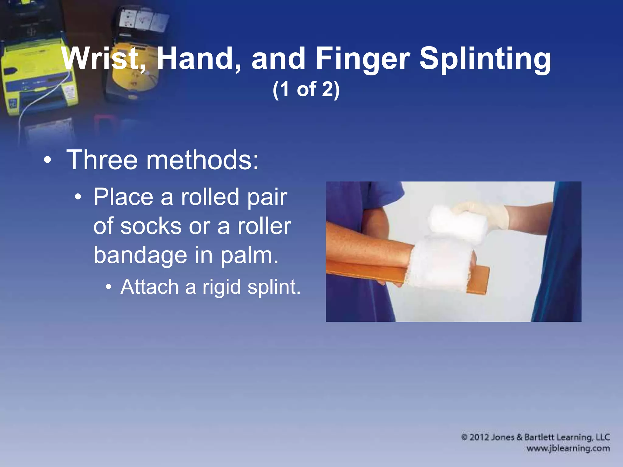 Chapter 16 Splinting Extremeties | PPTX