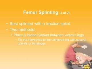 Fun Splinting Chapter 16 Splinting Extremeties | PPTX