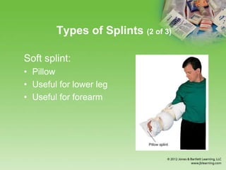 Chapter 16 Splinting Extremeties | PPTX