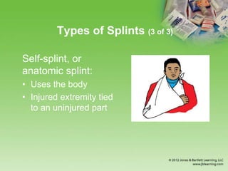 Chapter 16 Splinting Extremeties | PPTX