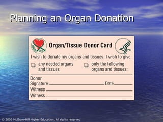Planning an Organ Donation 
