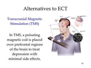 Alternatives to ECT Transcranial Magnetic Stimulation (TMS) In TMS, a pulsating magnetic coil is placed over prefrontal regions of the brain to treat depression with minimal side effects. 