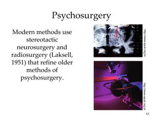 Psychosurgery Modern methods use stereotactic neurosurgery and radiosurgery (Laksell, 1951) that refine older methods of psychosurgery. http://www.epub.org.br http://www.epub.org.br 