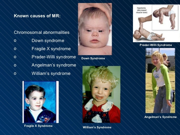 Chapter 17 mental retardation and autism