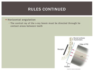 Horizontal angulation
 The central ray of the x-ray beam must be directed through he
contact areas between teeth
19
RULES CONTINUED
 