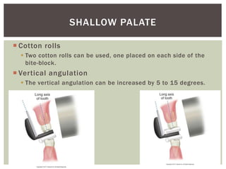  Cotton rolls
 Two cotton rolls can be used, one placed on each side of the
bite-block.
 Vertical angulation
 The vertical angulation can be increased by 5 to 15 degrees.
27
SHALLOW PALATE
 