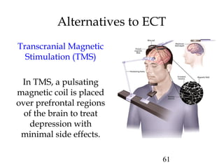 61
Alternatives to ECT
Transcranial Magnetic
Stimulation (TMS)
In TMS, a pulsating
magnetic coil is placed
over prefrontal regions
of the brain to treat
depression with
minimal side effects.
 