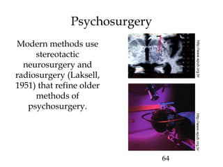 64
Psychosurgery
Modern methods use
stereotactic
neurosurgery and
radiosurgery (Laksell,
1951) that refine older
methods of
psychosurgery.
http://www.epub.org.brhttp://www.epub.org.br
 