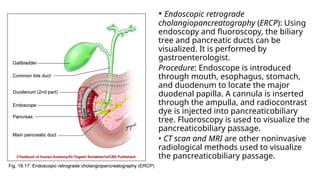Extrahepatic Biliary Apparatus for medical students.pptx