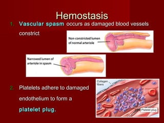 HemostasisHemostasis
1.1. Vascular spasmVascular spasm occurs as damaged blood vesselsoccurs as damaged blood vessels
constrictconstrict
2.2. Platelets adhere to damagedPlatelets adhere to damaged
endothelium to form aendothelium to form a
platelet plug.platelet plug.
 