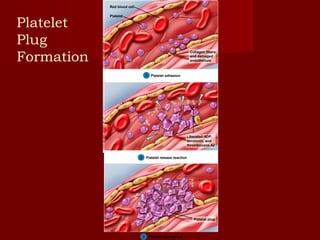 1
Red blood cell
Platelet
Collagen fibers
and damaged
endothelium
Platelet adhesion11
2
Red blood cell
Platelet
Collagen fibers
and damaged
endothelium
Liberated ADP,
serotonin, and
thromboxane A2
Platelet adhesion1
Platelet release reaction2
1
2
3
Red blood cell
Platelet
Collagen fibers
and damaged
endothelium
Liberated ADP,
serotonin, and
thromboxane A2
Platelet plug
Platelet adhesion1
Platelet release reaction2
Platelet aggregation3
Platelet
Plug
Formation
 