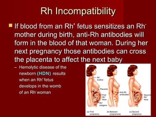 Rh IncompatibilityRh Incompatibility
 If blood from an RhIf blood from an Rh++
fetus sensitizes an Rhfetus sensitizes an Rh--
mother during birth, anti-Rh antibodies willmother during birth, anti-Rh antibodies will
form in the blood of that woman. During herform in the blood of that woman. During her
next pregnancy those antibodies can crossnext pregnancy those antibodies can cross
the placenta to affect the next babythe placenta to affect the next baby
– Hemolytic disease of theHemolytic disease of the
newbornnewborn (HDN)(HDN) resultsresults
when an Rhwhen an Rh++
fetusfetus
develops in the wombdevelops in the womb
of an Rhof an Rh--
womanwoman
 