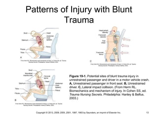 Patterns of Injury with Blunt
Trauma
Figure 19-1. Potential sites of blunt trauma injury in
unrestrained passenger and driver in a motor vehicle crash.
A, Unrestrained passenger in front seat. B, Unrestrained
driver. C, Lateral impact collision. (From Herm RL.
Biomechanics and mechanism of injury. In Cohen SS, ed.
Trauma Nursing Secrets. Philadelphia: Hanley & Belfus.
2003.)
Copyright © 2013, 2009, 2005, 2001, 1997, 1993 by Saunders, an imprint of Elsevier Inc. 13
 