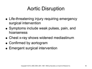 Copyright © 2013, 2009, 2005, 2001, 1997, 1993 by Saunders, an imprint of Elsevier Inc. 49
Aortic Disruption
 Life-threatening injury requiring emergency
surgical intervention
 Symptoms include weak pulses, pain, and
hoarseness
 Chest x-ray shows widened mediastinum
 Confirmed by aortogram
 Emergent surgical intervention
 