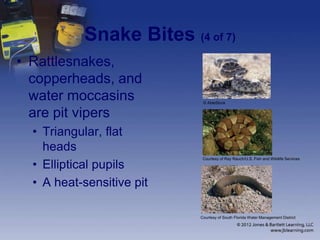 Snake Bites (4 of 7)
• Rattlesnakes,
copperheads, and
water moccasins
are pit vipers
• Triangular, flat
heads
• Elliptical pupils
• A heat-sensitive pit
© AbleStock
Courtesy of Ray Rauch/U.S. Fish and Wildlife Services
Courtesy of South Florida Water Management District
 