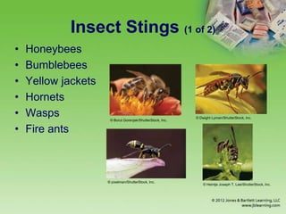 Insect Stings (1 of 2)
• Honeybees
• Bumblebees
• Yellow jackets
• Hornets
• Wasps
• Fire ants
© Borut Gorenjak/ShutterStock, Inc.
© Dwight Lyman/ShutterStock, Inc.
© pixelman/ShutterStock, Inc.
© Heintje Joseph T. Lee/ShutterStock, Inc.
 