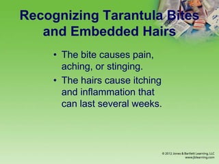 Recognizing Tarantula Bites
and Embedded Hairs
• The bite causes pain,
aching, or stinging.
• The hairs cause itching
and inflammation that
can last several weeks.
 