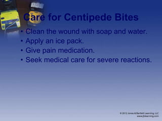 Care for Centipede Bites
• Clean the wound with soap and water.
• Apply an ice pack.
• Give pain medication.
• Seek medical care for severe reactions.
 
