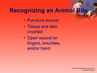 Recognizing an Animal Bite
• Puncture wound
• Tissue and skin
crushed
• Open wound on
fingers, knuckles,
and/or hand
 