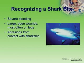 Recognizing a Shark Bite
• Severe bleeding
• Large, open wounds,
most often on legs
• Abrasions from
contact with sharkskin
© AbleStock
 