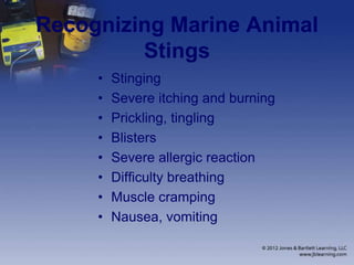 Recognizing Marine Animal
Stings
• Stinging
• Severe itching and burning
• Prickling, tingling
• Blisters
• Severe allergic reaction
• Difficulty breathing
• Muscle cramping
• Nausea, vomiting
 