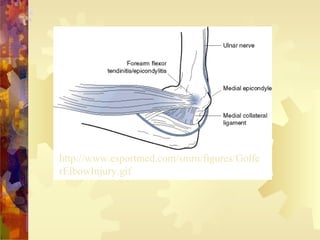 http://www.esportmed.com/smrn/figures/Golfe
rElbowInjury.gif
 