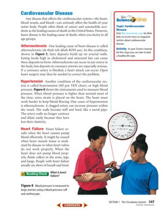 SECTION 1 The Circulatory System 547
Cardiovascular Disease
Any disease that affects the cardiovascular system—the heart,
blood vessels, and blood—can seriously affect the health of your
entire body. People often think of cancer and automobile acci-
dents as the leading causes of death in the United States. However,
heart disease is the leading cause of death, when you factor in all
age groups.
Atherosclerosis One leading cause of heart disease is called
atherosclerosis (ah thuh roh skluh ROH sus). In this condition,
shown in Figure 7, fatty deposits build up on arterial walls.
Eating foods high in cholesterol and saturated fats can cause
these deposits to form. Atherosclerosis can occur in any artery in
the body, but deposits in coronary arteries are especially serious.
If a coronary artery is blocked, a heart attack can occur. Open
heart surgery may then be needed to correct the problem.
Hypertension Another condition of the cardiovascular sys-
tem is called hypertension (HI pur TEN chun), or high blood
pressure. Figure 8 shows the instruments used to measure blood
pressure. When blood pressure is higher than normal most of
the time, extra strain is placed on the heart. The heart must
work harder to keep blood flowing. One cause of hypertension
is atherosclerosis. A clogged artery can increase pressure within
the vessel. The walls become stiff and hard, like a metal pipe.
The artery walls no longer contract
and dilate easily because they have
lost their elasticity.
Heart Failure Heart failure re-
sults when the heart cannot pump
blood efficiently. It might be caused
when heart muscle tissue is weak-
ened by disease or when heart valves
do not work properly. When the
heart does not pump blood prop-
erly, fluids collect in the arms, legs,
and lungs. People with heart failure
usually are short of breath and tired.
What is heart
failure?
Figure 8 Blood pressure is measured in
large arteries using a blood pressure cuff
and stethoscope.
Topic: Cardiovascular
Disease
Visit for Web
links to recent news or magazine
articles about cardiovascular
disease.
Activity In your Science Journal,
list five steps you can take to lead
a healthy life style.
life.msscience.com
(t)StudiOhio, (b)Matt Meadows
423-S1-MSS05_GLS 8/16/04 10:04 AM Page 547
 