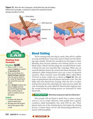 552 CHAPTER 19 Circulation
Blood Clotting
You’re running with your dog in a park, when all of a sudden
you trip and fall down. Your knee starts to bleed, but the bleed-
ing stops quickly. Already the wounded area has begun to heal.
Bleeding stops because platelets and clotting factors in your
blood make a blood clot that plugs the wounded blood vessels.
A blood clot also acts somewhat like a bandage. When you cut
yourself, platelets stick to the wound and release chemicals. Then
substances called clotting factors carry out a series of chemical
reactions. These reactions cause threadlike fibers called fibrin
(FI brun) to form a sticky net, as shown in Figure 12. This net
traps escaping blood cells and plasma and forms a clot. The clot
helps stop more blood from escaping. After the clot is in place
and becomes hard, skin cells begin the repair process under the
scab. Eventually, the scab is lifted off. Bacteria that might get into
the wound during the healing process are destroyed by white
blood cells.
What blood components help form blood clots?
Most people will not bleed to death from a minor wound,
such as a cut or scrape. However, some people have a genetic
condition called hemophilia (hee muh FIH lee uh). Their
plasma lacks one of the clotting factors that begins the clotting
process. A minor injury can be a life threatening problem for a
person with hemophilia.
Red blood cells
White blood cells Fibrin
Platelets
Platelets
Wood splinter
Figure 12 When the skin is damaged, a sticky blood clot seals the leaking
blood vessel. Eventually, a scab forms to protect the wound from further
damage and allow it to heal.
Modeling Scab
Formation
Procedure
1. Place a 5-cm ϫ 5-cm
square of gauze on a piece
of aluminum foil.
2. Place several drops of a
liquid bandage solution
onto the gauze and let it
dry. Keep the liquid band-
age away from eyes and
mouth.
3. Use a dropper to place one
drop of water onto the
area of the liquid bandage.
Place another drop of
water in another area of
the gauze.
Analysis
1. Compare the drops of
water in both areas.
2. Describe how the treated
area of the gauze is like
a scab.
423-S2-MSS05_GLS 8/16/04 10:05 AM Page 552
 