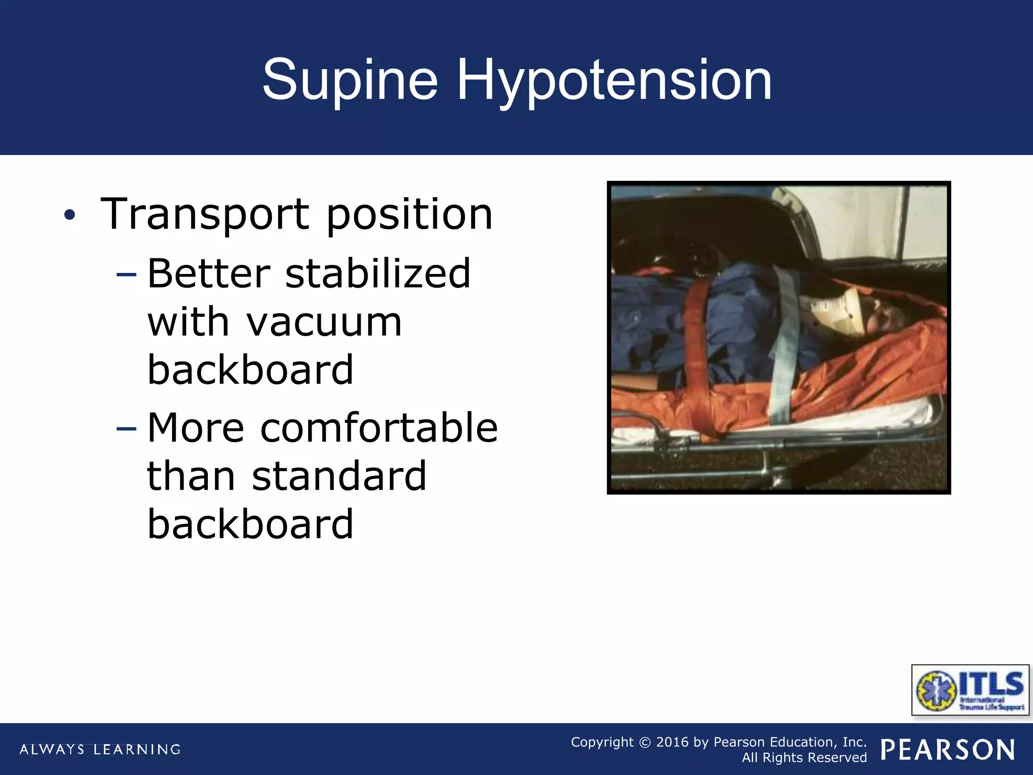 Copyright © 2016 by Pearson Education, Inc.
All Rights Reserved
Supine Hypotension
• Transport position
– Better stabilized
with vacuum
backboard
– More comfortable
than standard
backboard
 