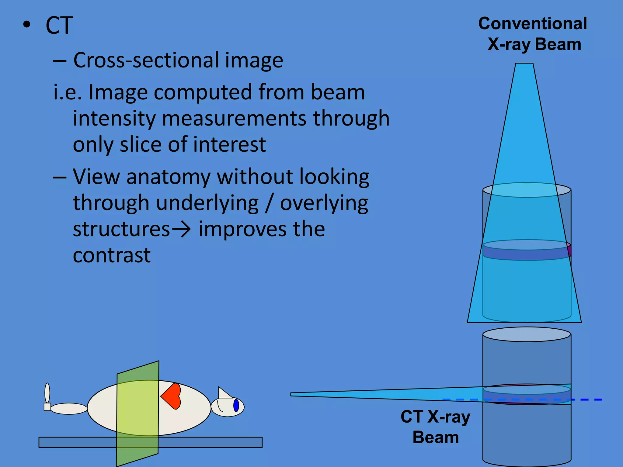 Chapter 1 basic principles of ct | PPTX