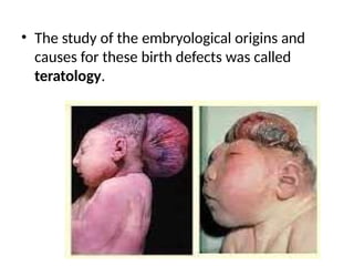 • The study of the embryological origins and
causes for these birth defects was called
teratology.
 