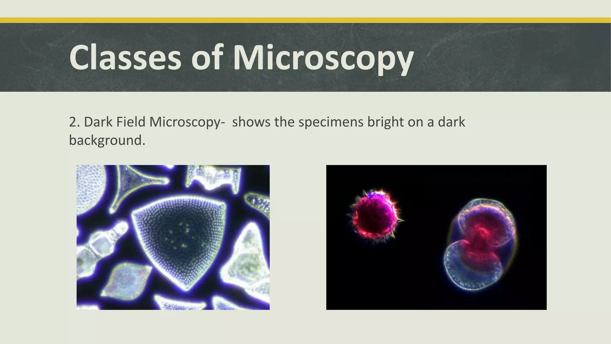 Classes of Microscopy
2. Dark Field Microscopy- shows the specimens bright on a dark
background.
 