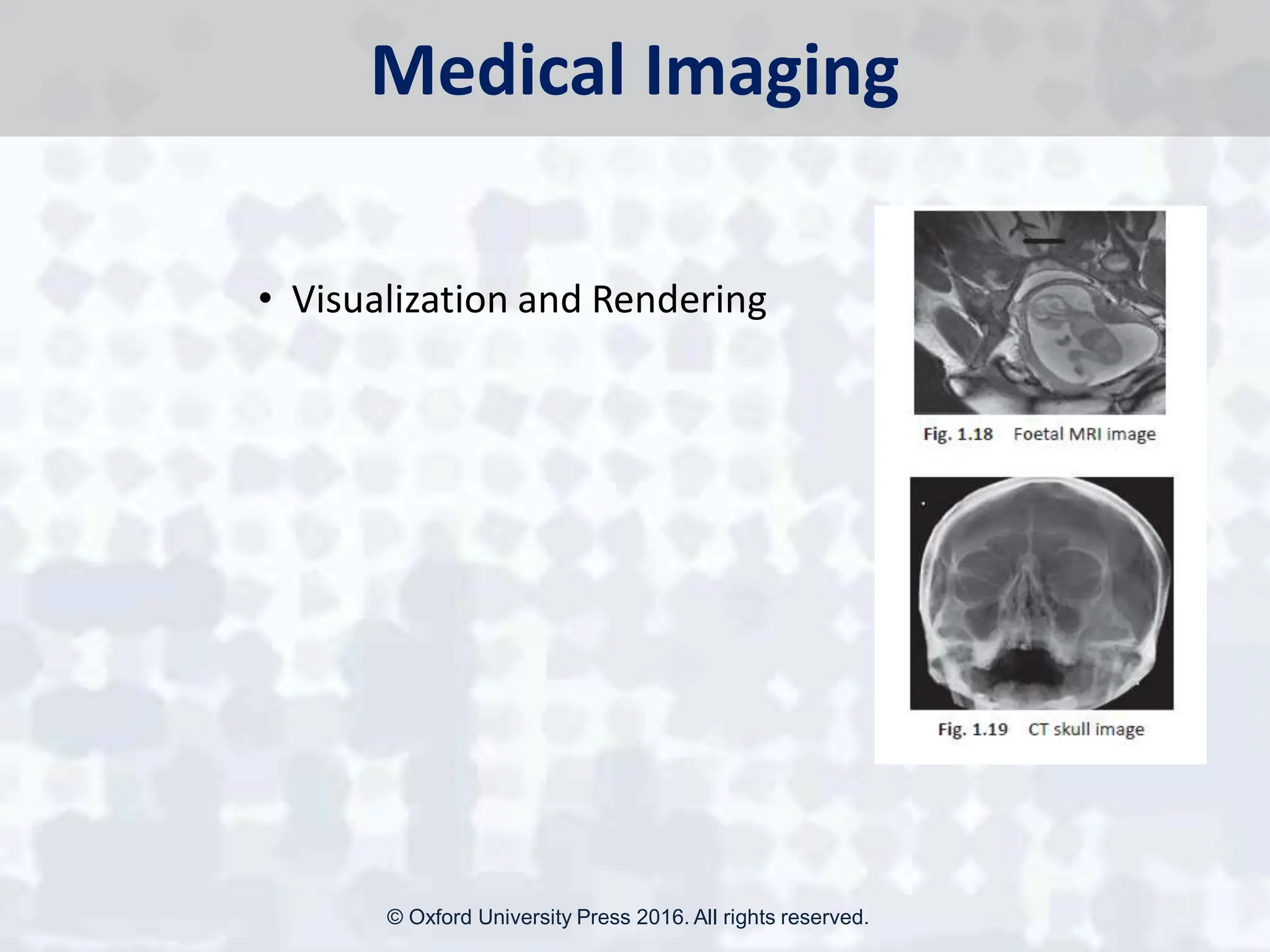 Medical Imaging
• Visualization and Rendering
© Oxford University Press 2016. All rights reserved.
 
