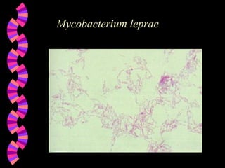 Mycobacterium leprae 