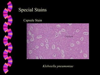 Special Stains Capsule Stain Klebsiella pneumoniae 