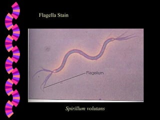 Flagella Stain Spirillum volutans 