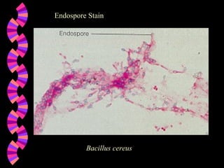 Endospore Stain Bacillus cereus 