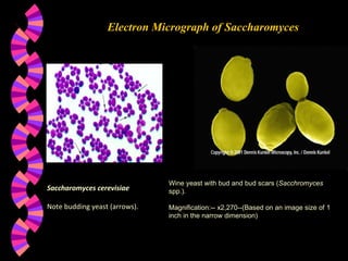 Electron Micrograph of Saccharomyces Saccharomyces cerevisiae Note budding yeast (arrows).  Wine yeast with bud and bud scars ( Sacchromyces  spp.).  Magnification:-- x2,270--(Based on an image size of 1 inch in the narrow dimension) 
