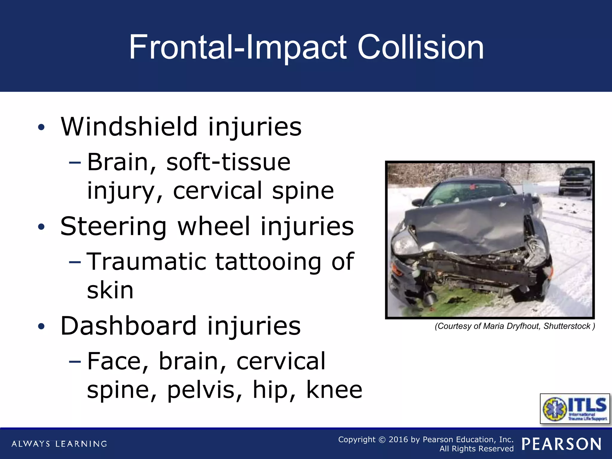 Copyright © 2016 by Pearson Education, Inc.
All Rights Reserved
Frontal-Impact Collision
• Windshield injuries
– Brain, soft-tissue
injury, cervical spine
• Steering wheel injuries
– Traumatic tattooing of
skin
• Dashboard injuries
– Face, brain, cervical
spine, pelvis, hip, knee
(Courtesy of Maria Dryfhout, Shutterstock )
 