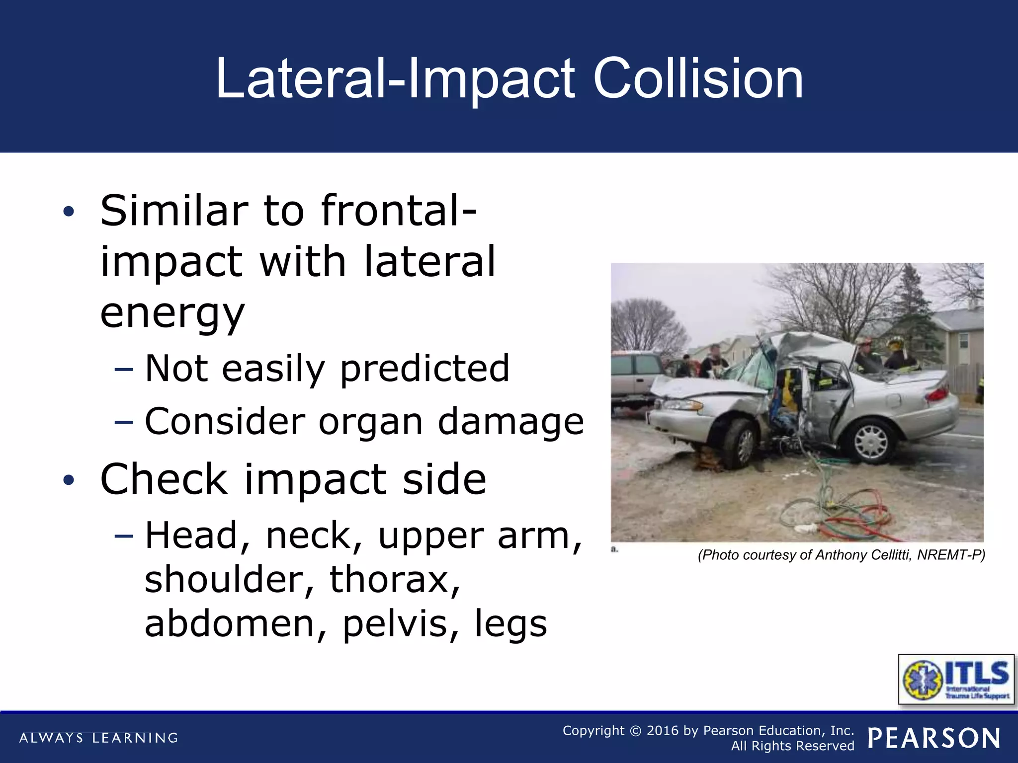 Copyright © 2016 by Pearson Education, Inc.
All Rights Reserved
Lateral-Impact Collision
• Similar to frontal-
impact with lateral
energy
– Not easily predicted
– Consider organ damage
• Check impact side
– Head, neck, upper arm,
shoulder, thorax,
abdomen, pelvis, legs
(Photo courtesy of Anthony Cellitti, NREMT-P)
 